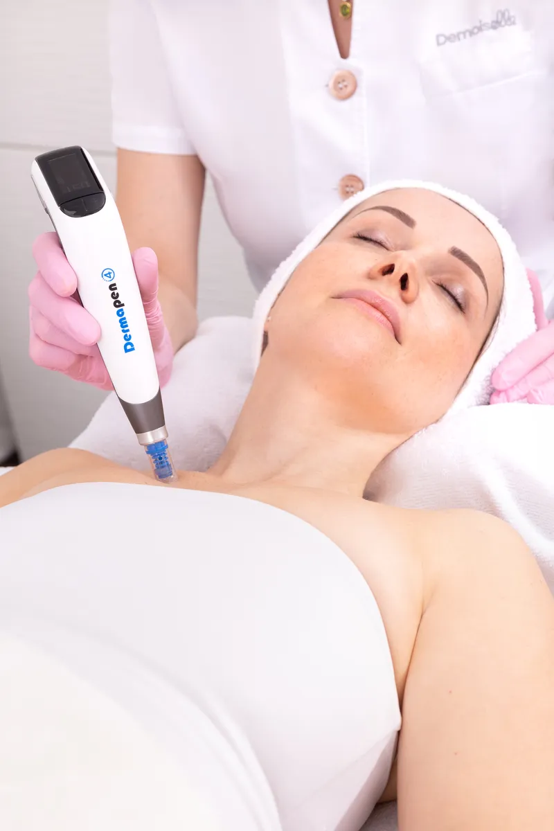 Apparative Spezialbehandlung mit Micro-Needling-Gerät